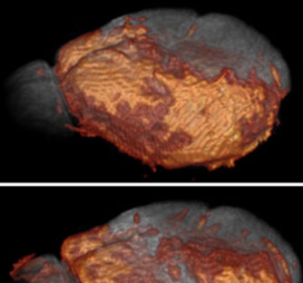 Drug evaluation on functional neuroimaging using Mn2+ Enhanced MRI